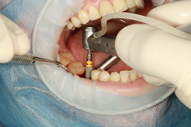 dental implant treatments in city of london
